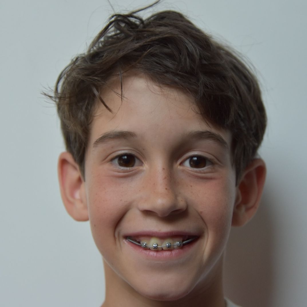 MATEO
