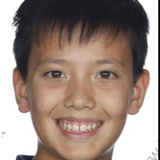 MARCUS
