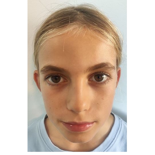 KLARA