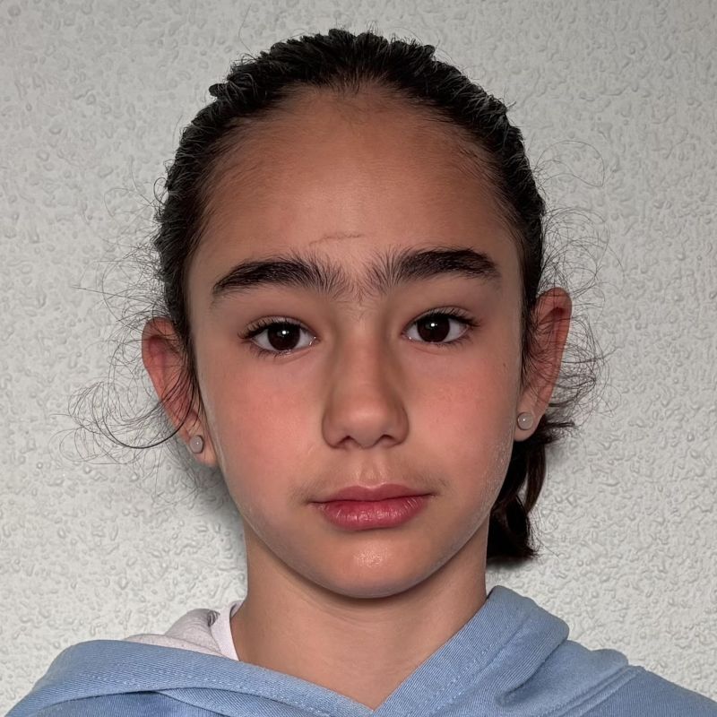 NOA