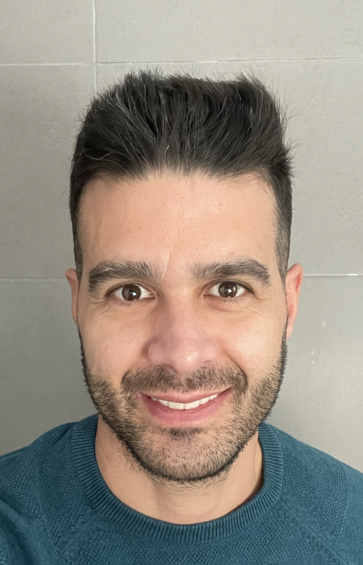 ALBERTO