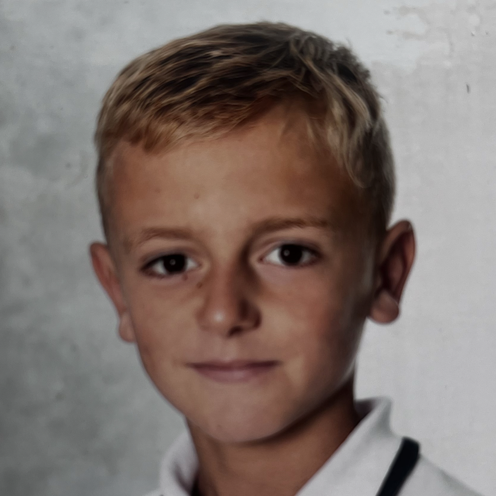 NOE