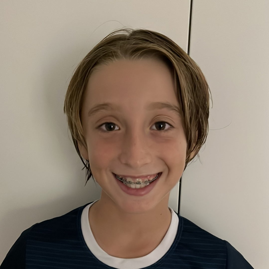 ALBERTO